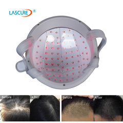 LASCURE® 82 Laser Helmet