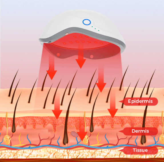 laser  for hair growth.png